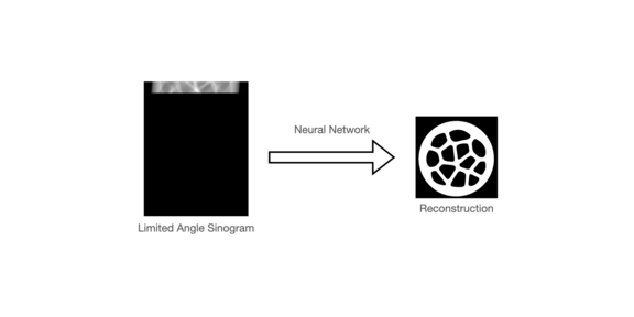 A neural network used to reconstruct images from a limited angle sinogram.
